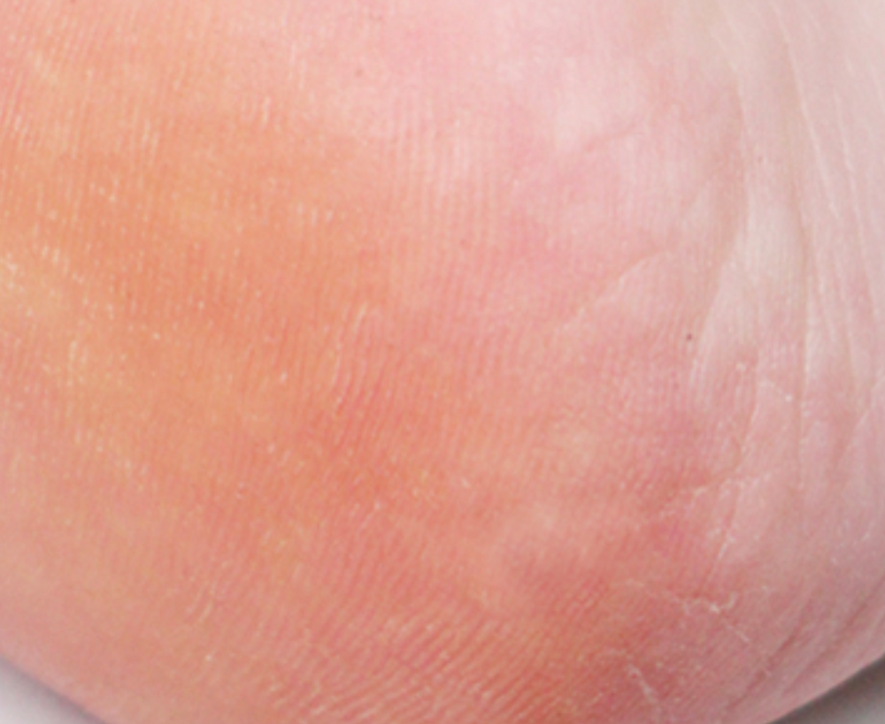 PLU — Körperpeeling mit weißem Moschus, 2 × 200 g